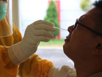 新冠肺炎-COVID19-鼻咽拭子-新冠病毒檢測-腦膨出-腦脊髓液-香港財經時報HKBT