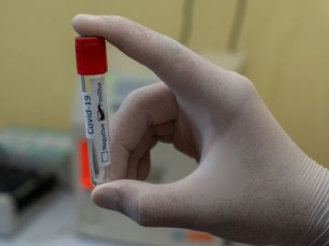 巴西臨床數據-中國科興疫苗功效-科興疫苗技術-副作用-香港財經時報HKBT
