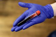 中國生物科技服務：英諾特委任標準病理為分銷商 涉及檢測新型冠狀病毒試劑盒產品