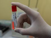 巴西臨床數據：中國科興疫苗功效得50.4%！科興疫苗技術及副作用一覽
