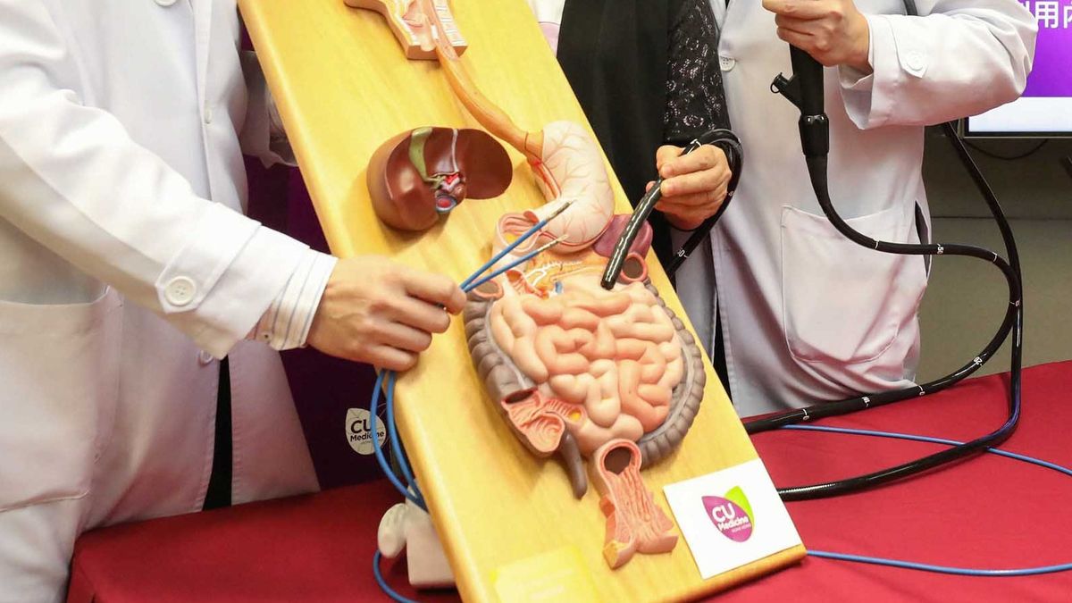 大腸癌篩查計劃2022, 港人參加, 登記, 大腸鏡檢查資助額, 香港財經時報