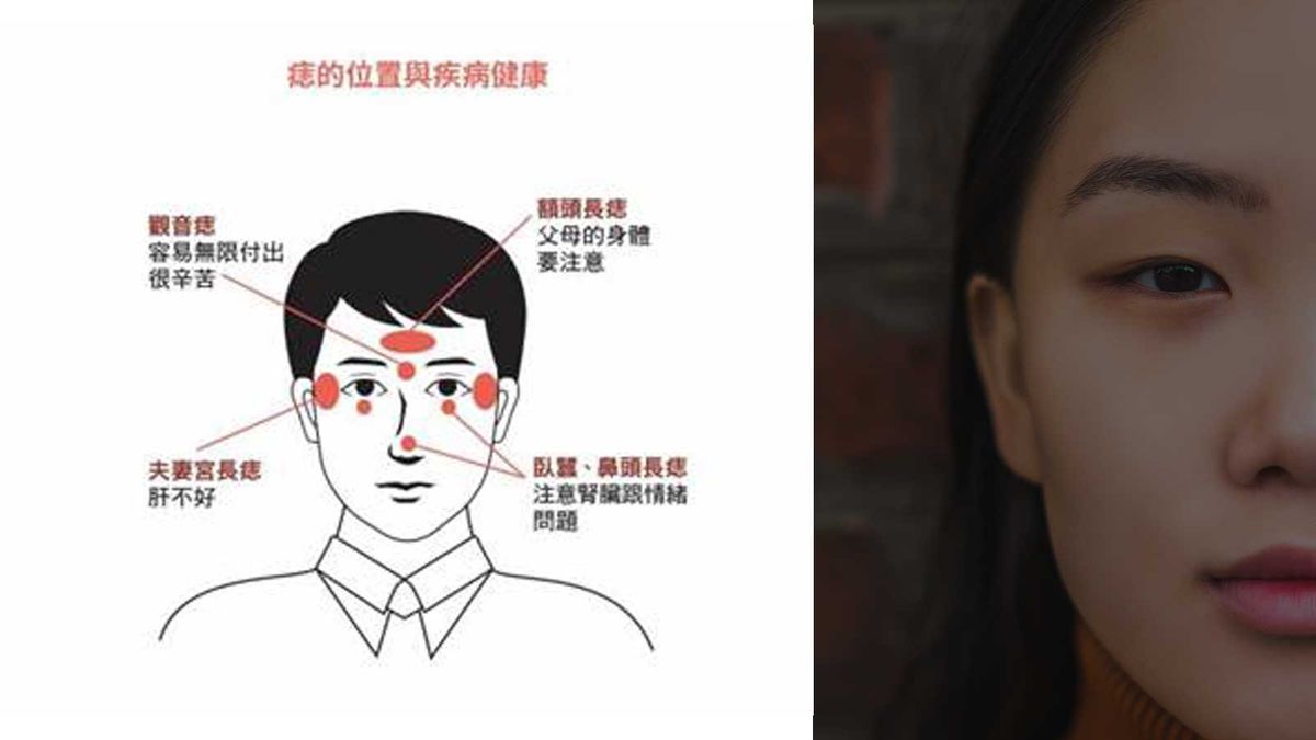 面相學︰長痣有好有壞？觀音痣容易無限付出很辛苦｜硃砂痣大富大貴｜「這4痣」千萬要小心