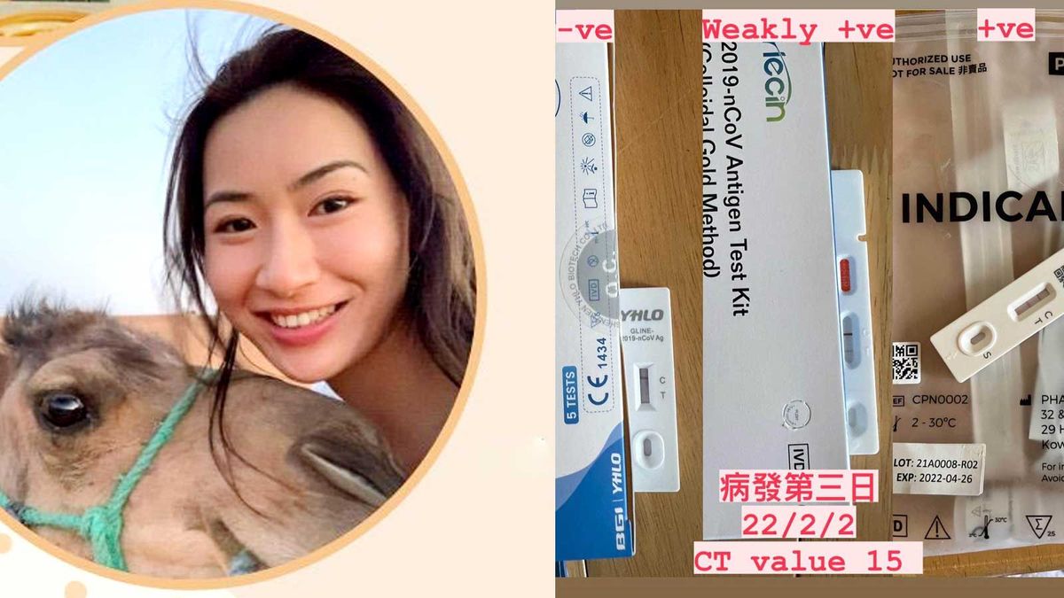 90後香港女醫生｜分享自身確診經歷｜陰性不代表「無中招」｜食藥以外教3招輕鬆面對