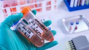 新冠疫情｜Omicron亞型BA.2的傳染力、致病率再提升？最新研究解開4大疑團