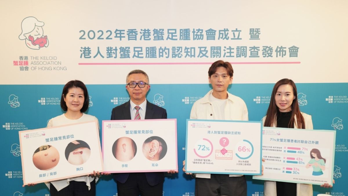 健康生活｜逾7成港人未聽過「蟹足腫」！暗瘡、穿耳等均可引起