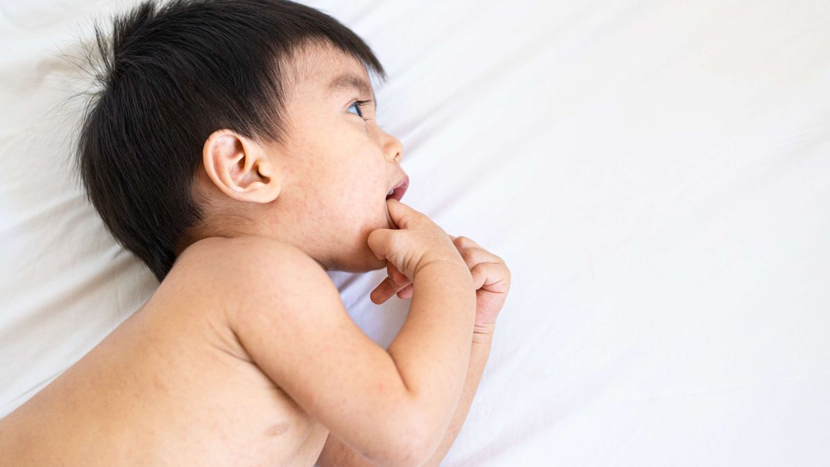 兒童健康｜兩歲前嬰兒易染玫瑰疹！傳染性高、持續發燒怎麽辦？｜兒科診療室