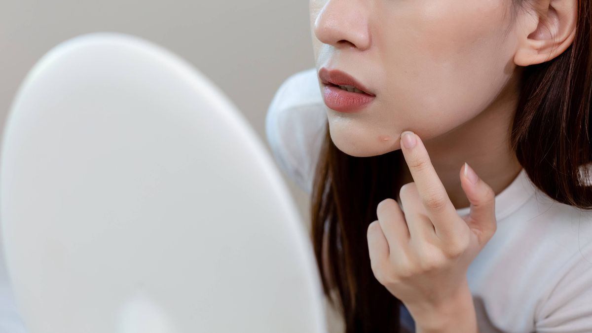健康生活｜荷爾蒙失調至月經亂、生暗瘡？專科醫生：特徵及解決方法