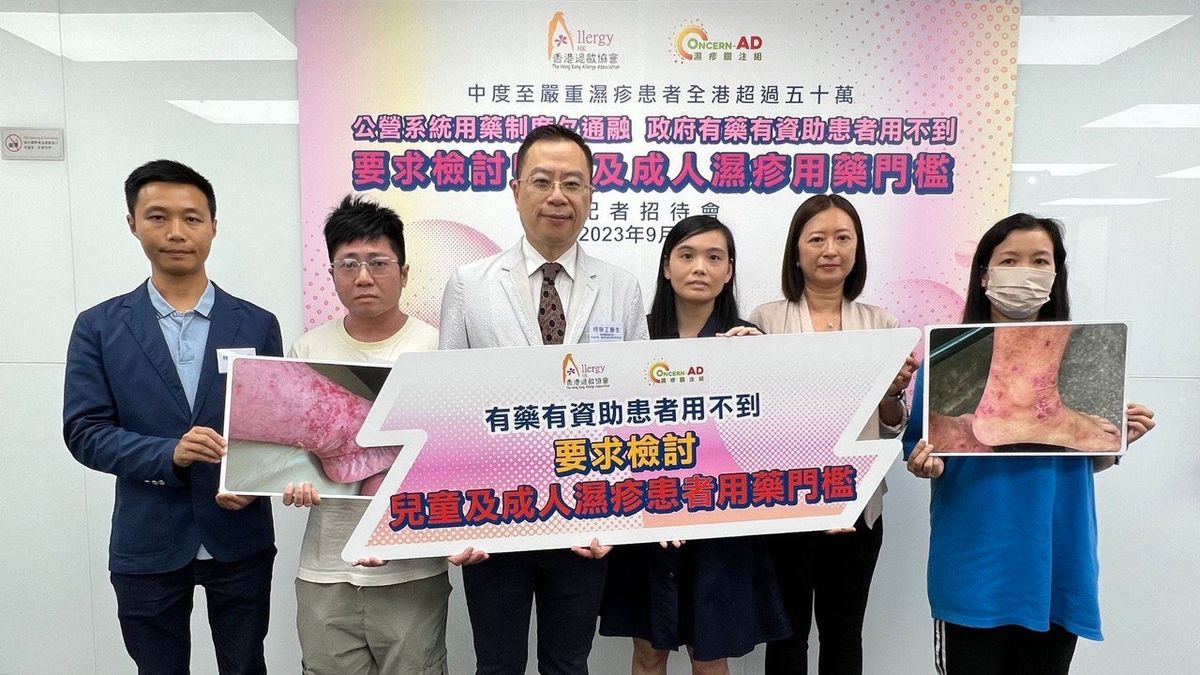 健康生活｜全港逾50萬人患中度至嚴重濕疹！生物製劑有效控制病情