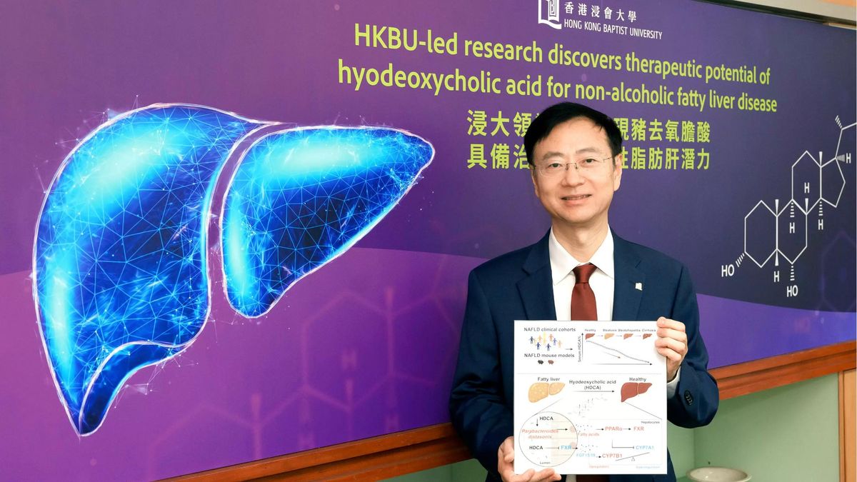 32%成年人患非酒精性脂肪肝！浸大研究：腸道膽汁酸具治療作用